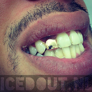 Gold Plated Tooth